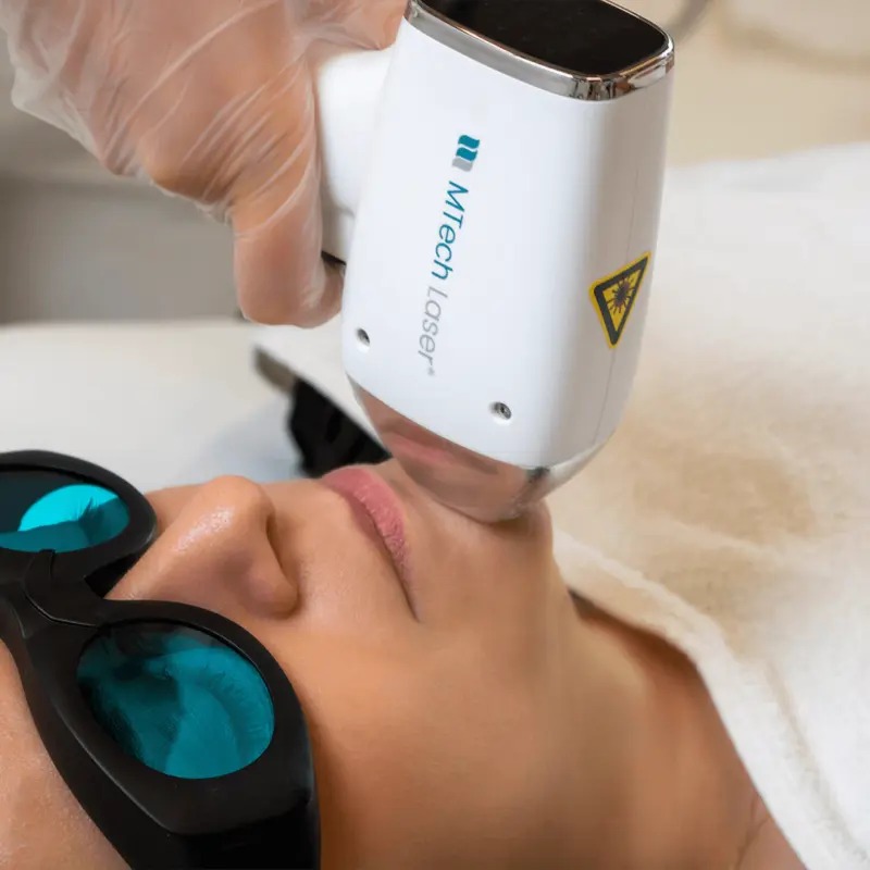 MTech diodni laser – profesionalni uređaj nemačkog kvaliteta